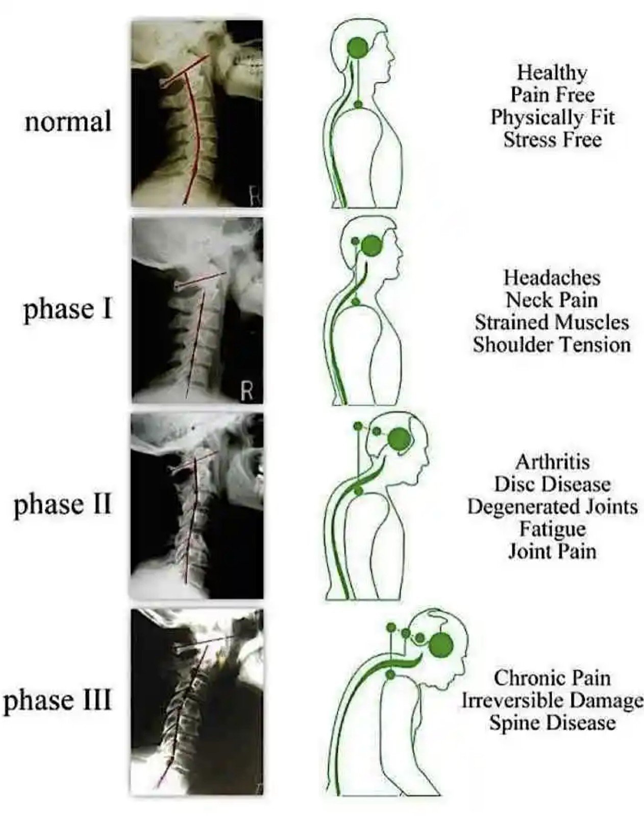 Ne Cervical Spine