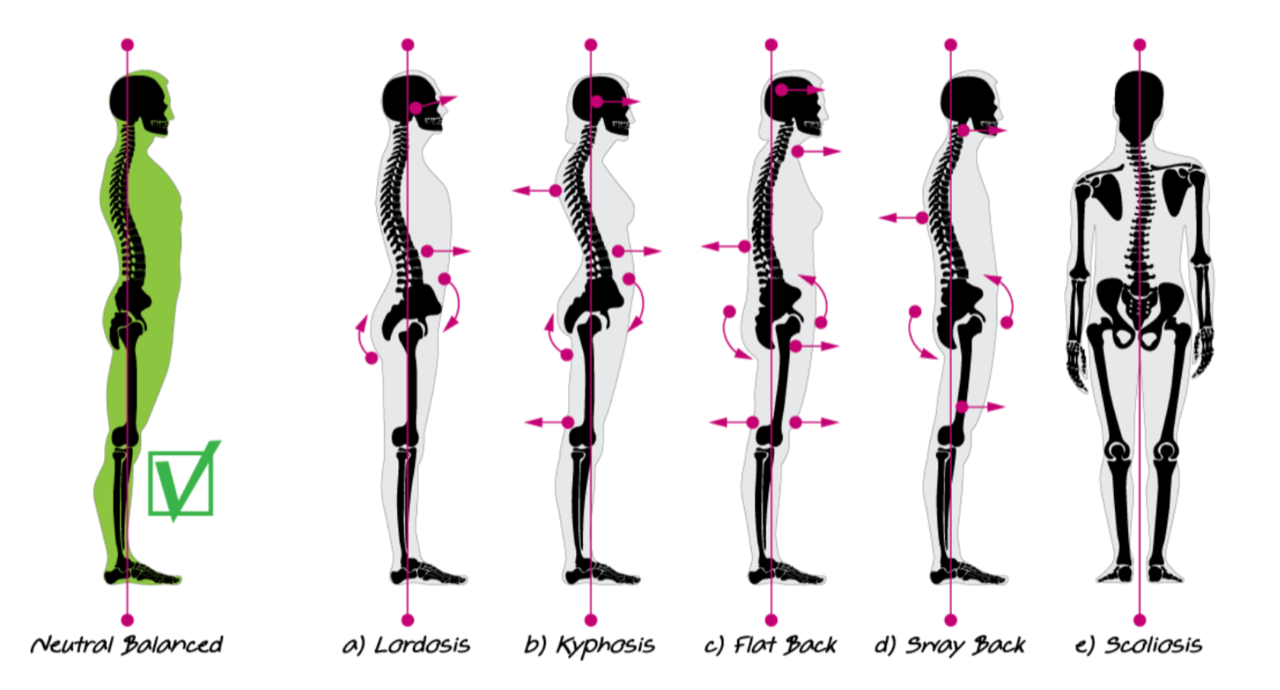 Thoracic Spine